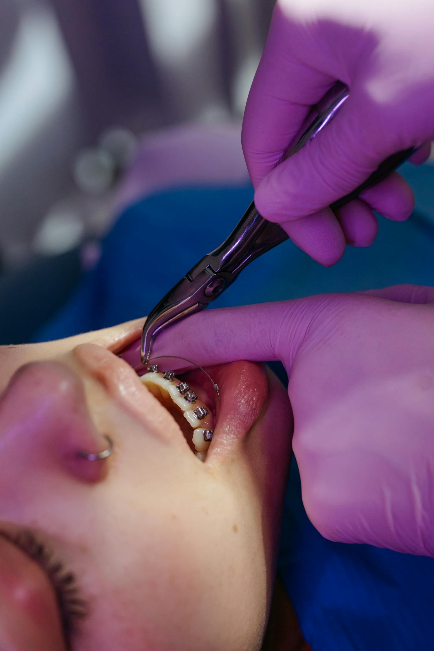 Atendimento ortodôntico com aparelho e instrumentos odontológicos